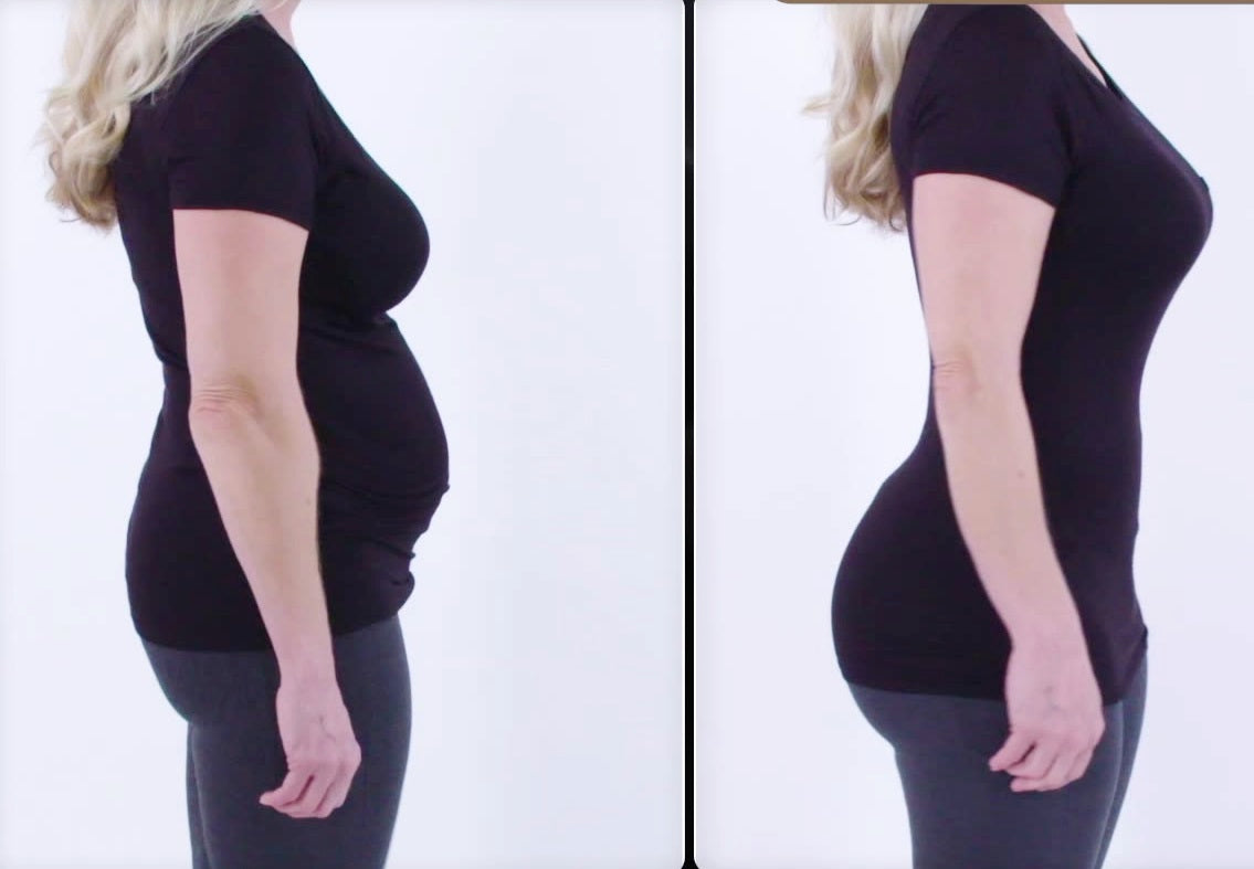 Velform Tvarující prádlo s křížovou kompresí 4 