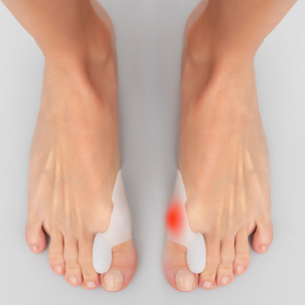 Silikonový Chránič a Korektor Vbočeného Palce Bunilief InnovaGoods, 2 ks v balení 1 